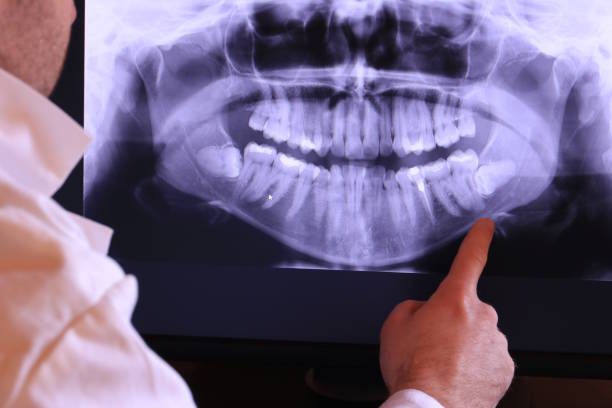Best Emergency Dental Care for Broken or Chipped Teeth in Rutgers University Livingston Campus, NJ