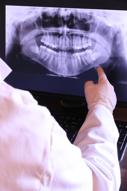 Best Weekend Emergency Dentist in Rutgers University Livingston Campus, NJ